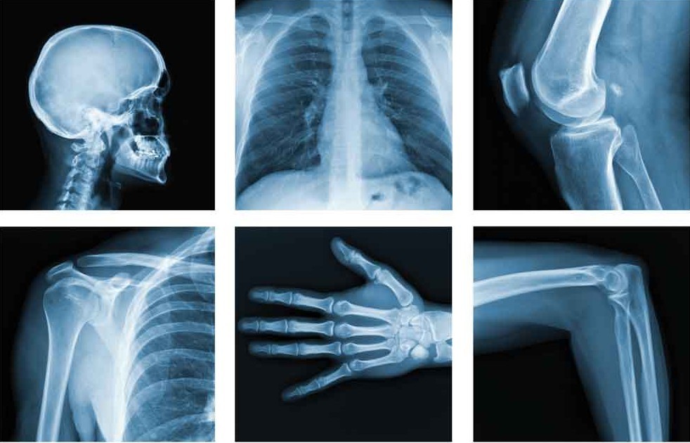 Рентгеновское излучение фото для презентации