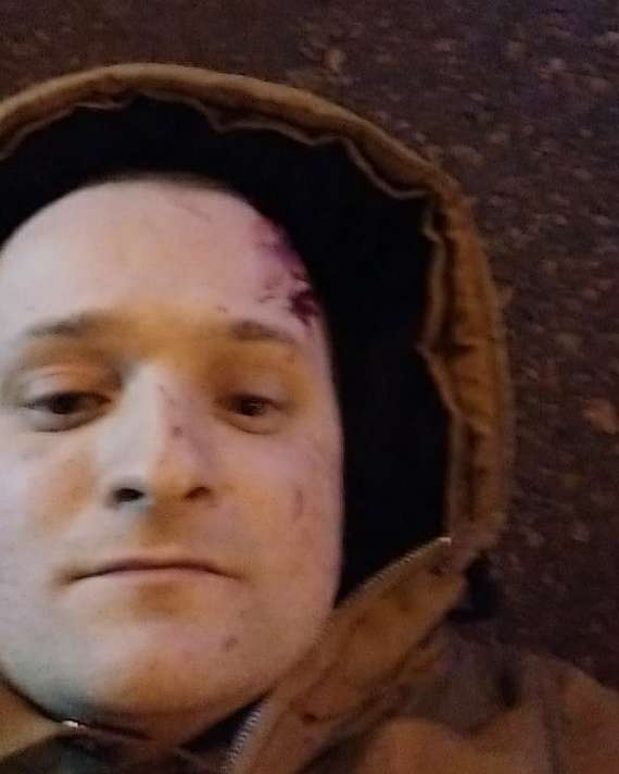 “I was hit at the city police station on a zebra crossing,” a Zaporozhian resident wrote yesterday on social networks while lying on the road. What kind of selfies do you like? - Road accident, Selfie, Zaporizhzhia