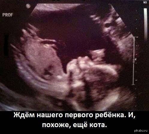 Cats on ultrasound images - My, Ultrasound, cat, The photo, Funny