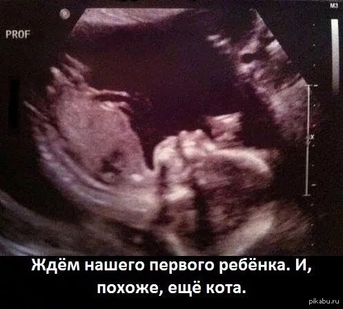 Cats on ultrasound images - My, Ultrasound, cat, The photo, Funny