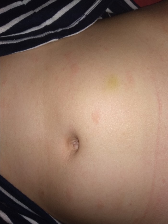 Появились пятнышки на теле