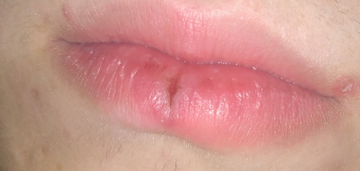 ���� ��������