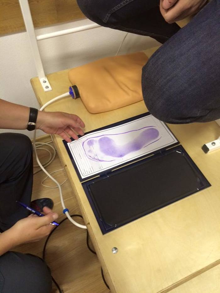 Плоскостопие и биомеханика стопы