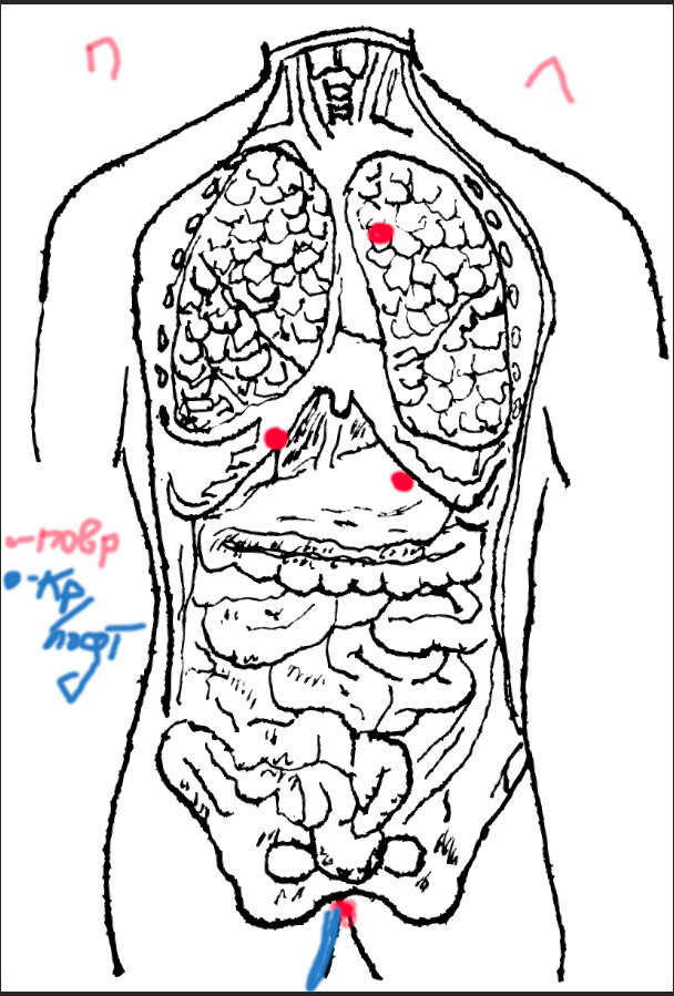 Reply to the post “The body in room 348” - My, The crime, Crime, Murder, Расследование, Mystery, Reply to post, Longpost