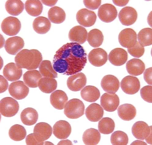 Our internal troops: eosinophils - My, Immunity, Immunology, Biology, Video, Longpost