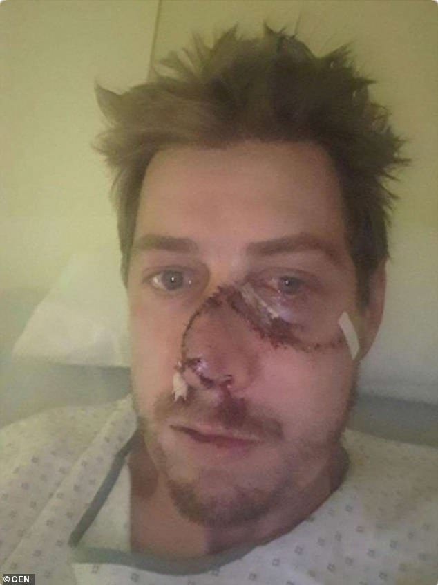 Karma: a deer tore a hunter's face - Karma, Hunting, Longpost