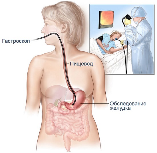 Part 2. Everyday life in the surgery department or how to test your nerves for strength - My, Blog, Hospital, Description, Fast, Longpost