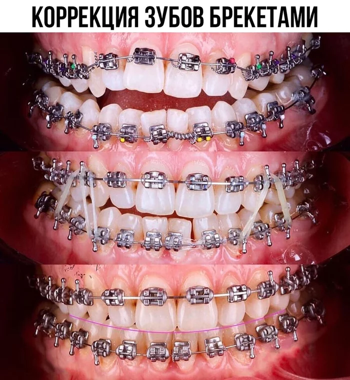 Beautiful work - The medicine, Dentistry, Braces, Work, The photo