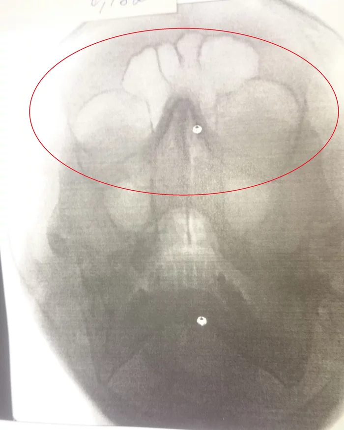 X-ray of the nose - My, X-ray, Ambulance