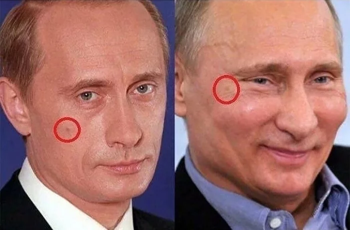 The unusual journey of Putin's birthmark - Plastic, Cloning, Vladimir Putin