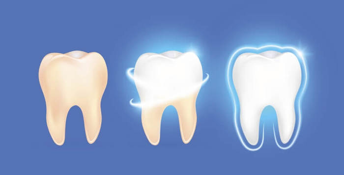 Это расизм?