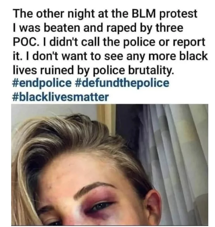 A photograph of beaten Anastasia Yankova was passed off as a victim of violence in the United States - Black lives matter, MMA fighter, Anastasia Yankova