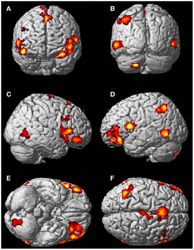 10% of the brain. Again - Brain, Myths, Alternative, GIF, Longpost