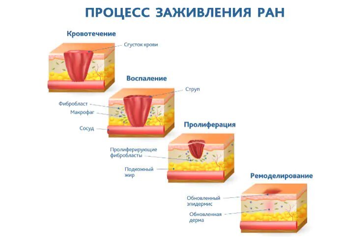 Порезы бумагой одни из самых болезненных. Почему? - Бумага, Порез, Боль, Интересное, Статья, Длиннопост