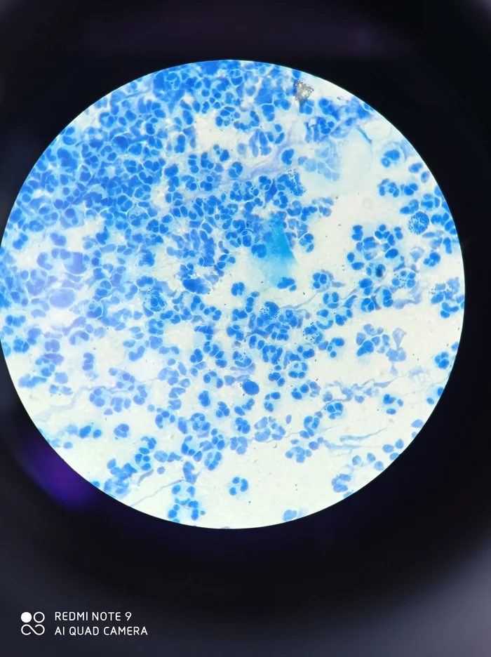 Fruits of love - My, Laboratory, Analysis, Kld, Smear, Microscope, Microscopy, Leukocytes, Longpost