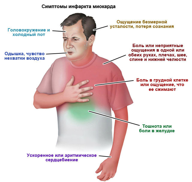 Щитовидная железа после инсульта thumbnail