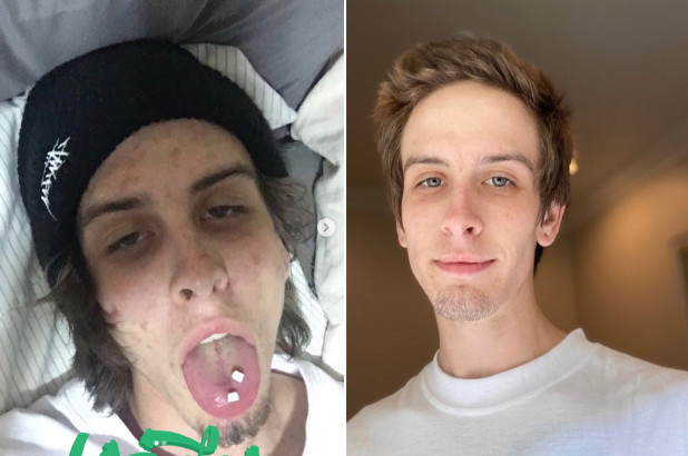 Photos of a former drug addict before and after rehabilitation! - Addiction, Drug addicts, Rehabilitation, Rehabilitation of drug addicts, Opiates, Addiction, It Was-It Was, Before and after, Longpost
