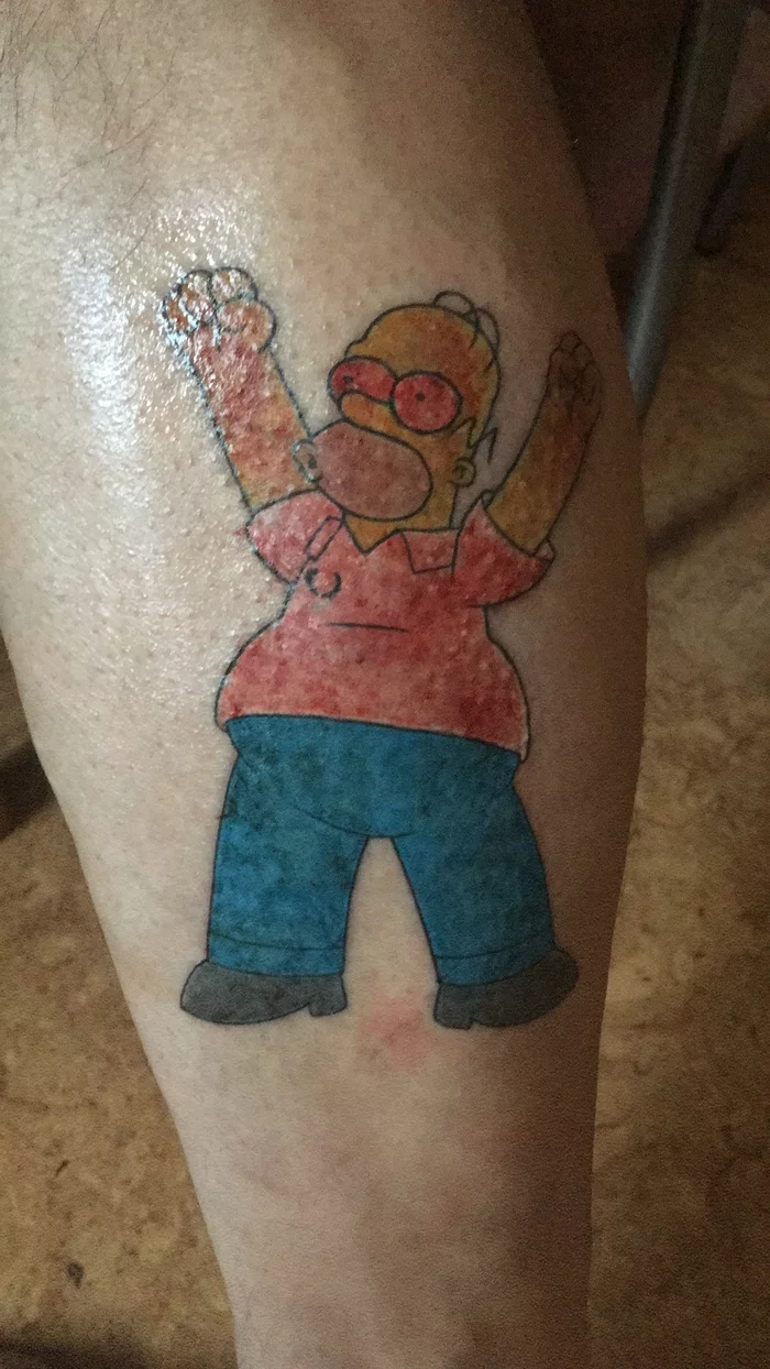 Bad tattoo experience - My, Infection, Homer Simpson, Tattoo, Longpost