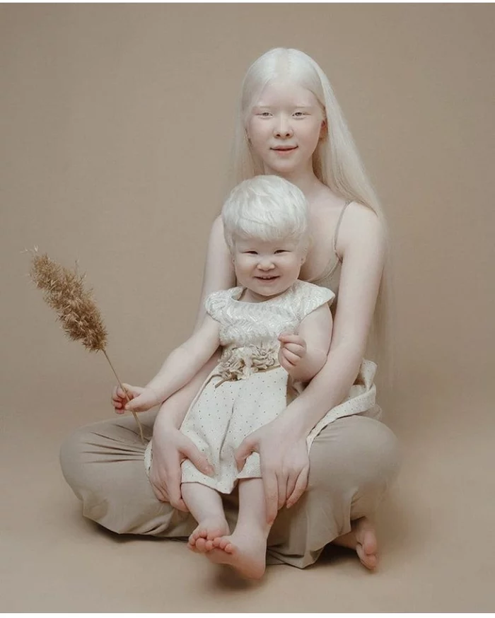 Albino sisters from Aktau - Children, Sisters, Albino, Aktau, Longpost, Kazakhstan