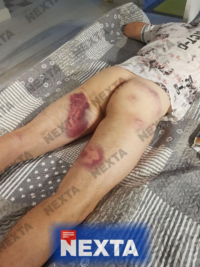 Катували електрошокером, ножем вистригали волосся, фарбували голови, - звільнений протестувальник про жахи в СІЗО Білорусі - Цензор.НЕТ 1746