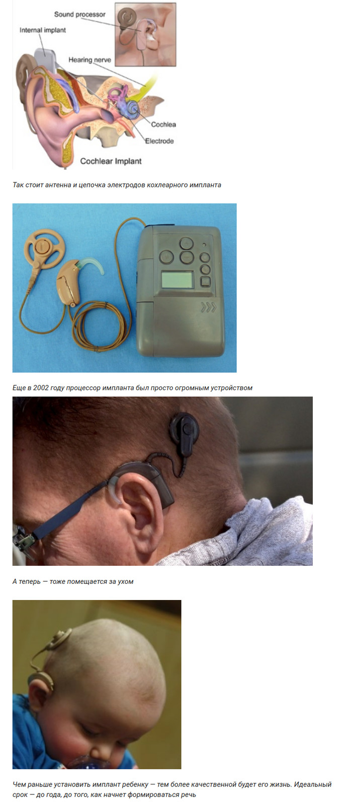Слуховой аппарат – от рупора Циолковского до современности Cat_Cat, История, Слуховой аппарат, Слух, Длиннопост