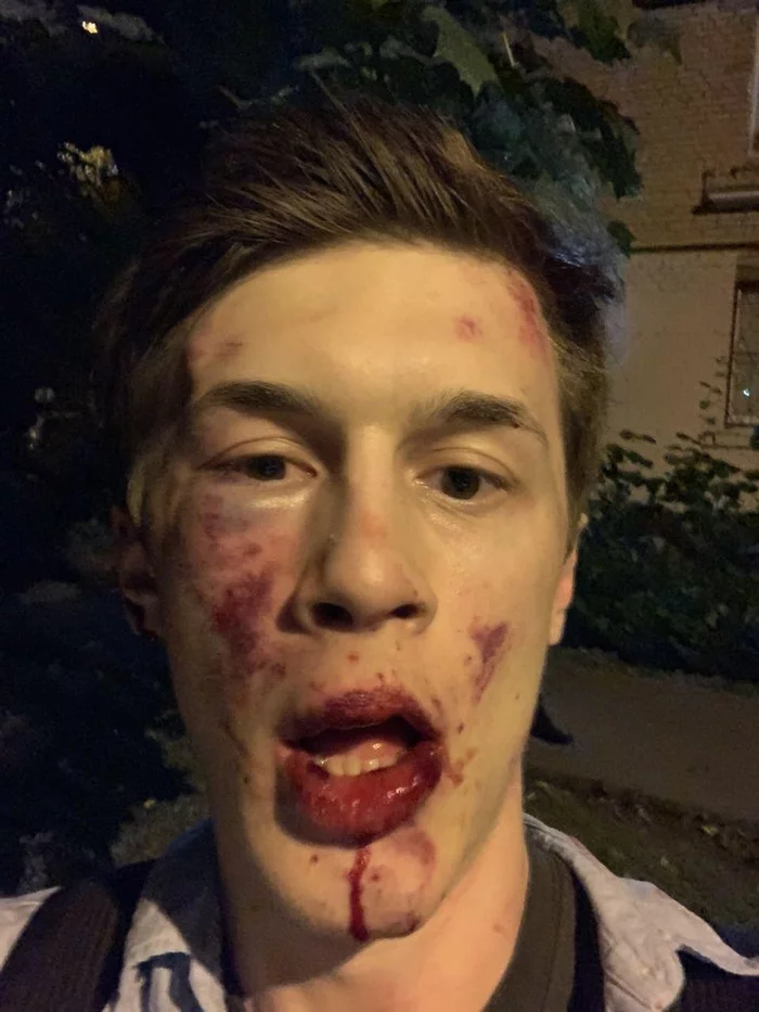 Yegor Zhukov beaten by Putin's Red Guards - Politics, Attack, Longpost, Stuffing, Negative, Egor Zhukov, Beatings, Beating