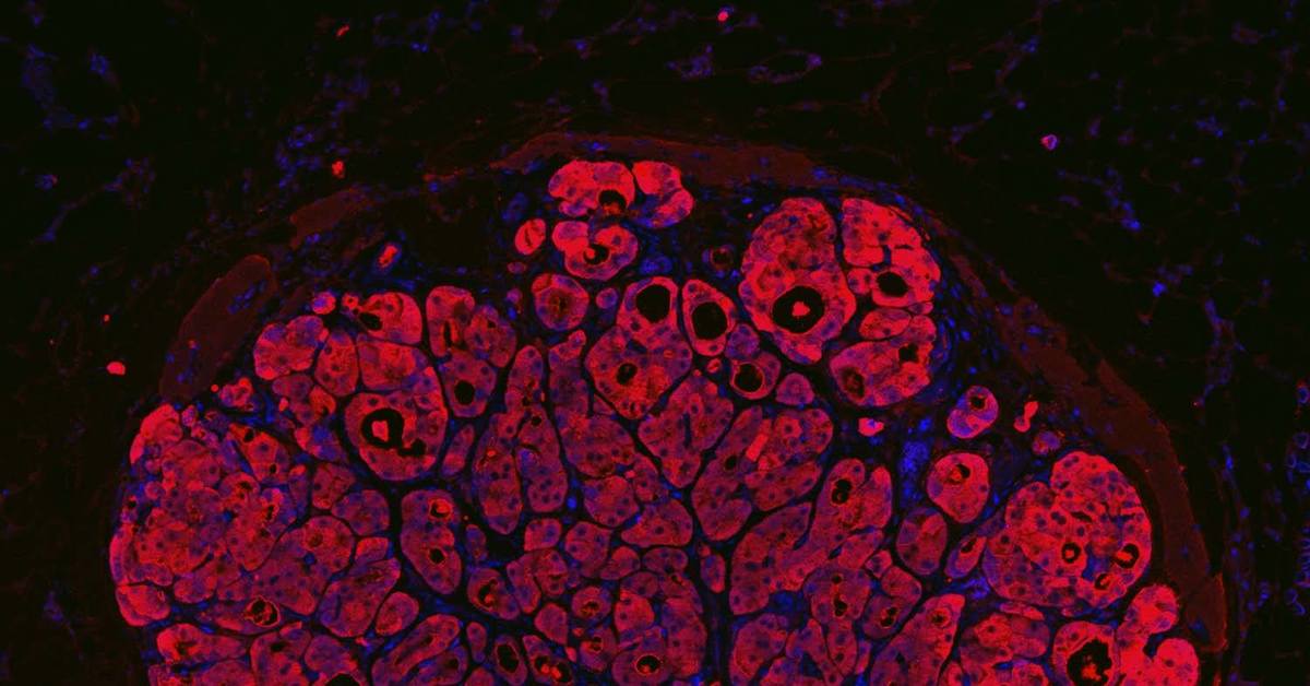 Стволовые клетки печени. Клетки печени гепатоциты. Многоядерные клетки печени. Клетки печени под микроскопом. Гепатоцит под микроскопом.