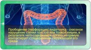 Как хирурги аппендицит лечили - Моё, Хирург, Аппендицит, Медицина, Кости, Диагностика, Длиннопост