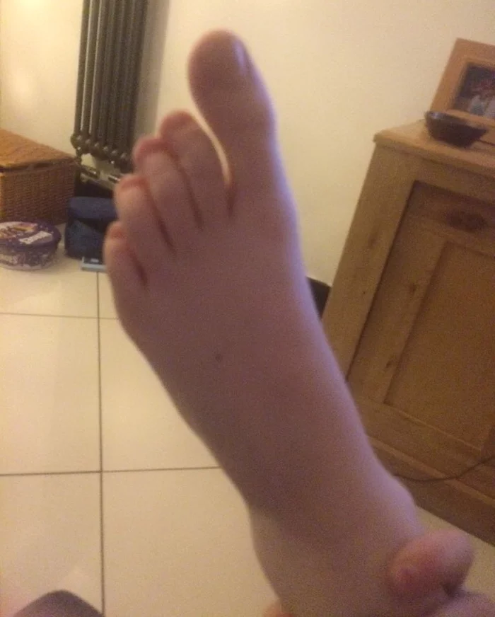 SHOCK! The longest big toe - My, Feet, Legs, Thumb