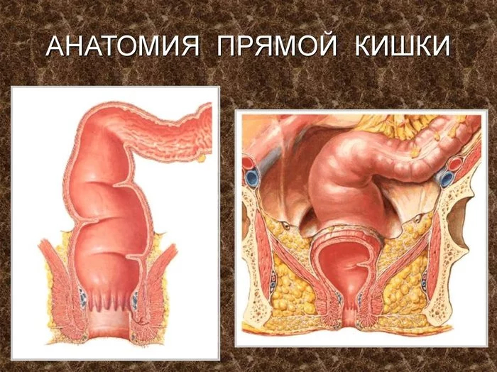 Первый анальный секс. Что, как, зачем? - NSFW, Моё, Секс, Секс-Шоп, Секс-Игрушки, Анальный секс, Анальная пробка, Анальная смазка, Длиннопост