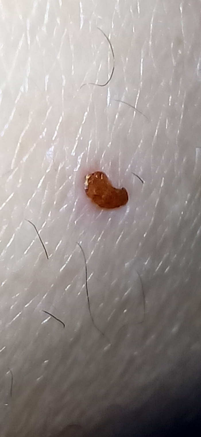     ? , , 