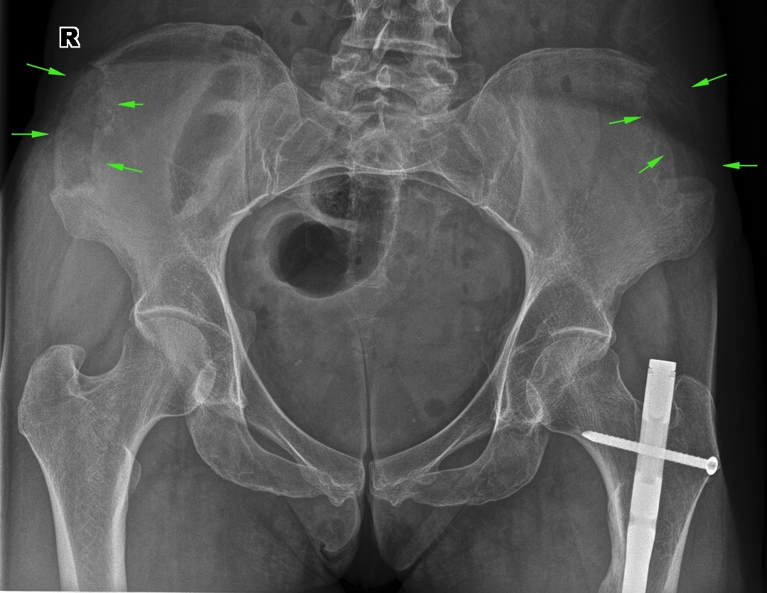 From the life of a radiologist. Part 22. Traumatic. - My, X-ray, The medicine, Longpost