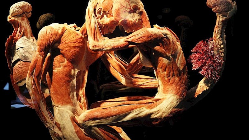 Plastination - insanity or art? - Plastination, Mummy, , Exhibition, , Dead body, Longpost, GГјnther von Haggens