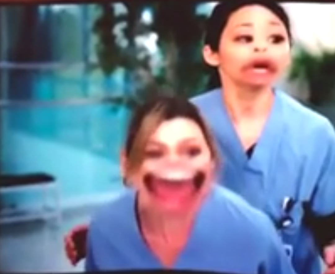 Snapchat filters will turn any drama into a comedy - Reddit, Grey's Anatomy, Humor, Snapchat