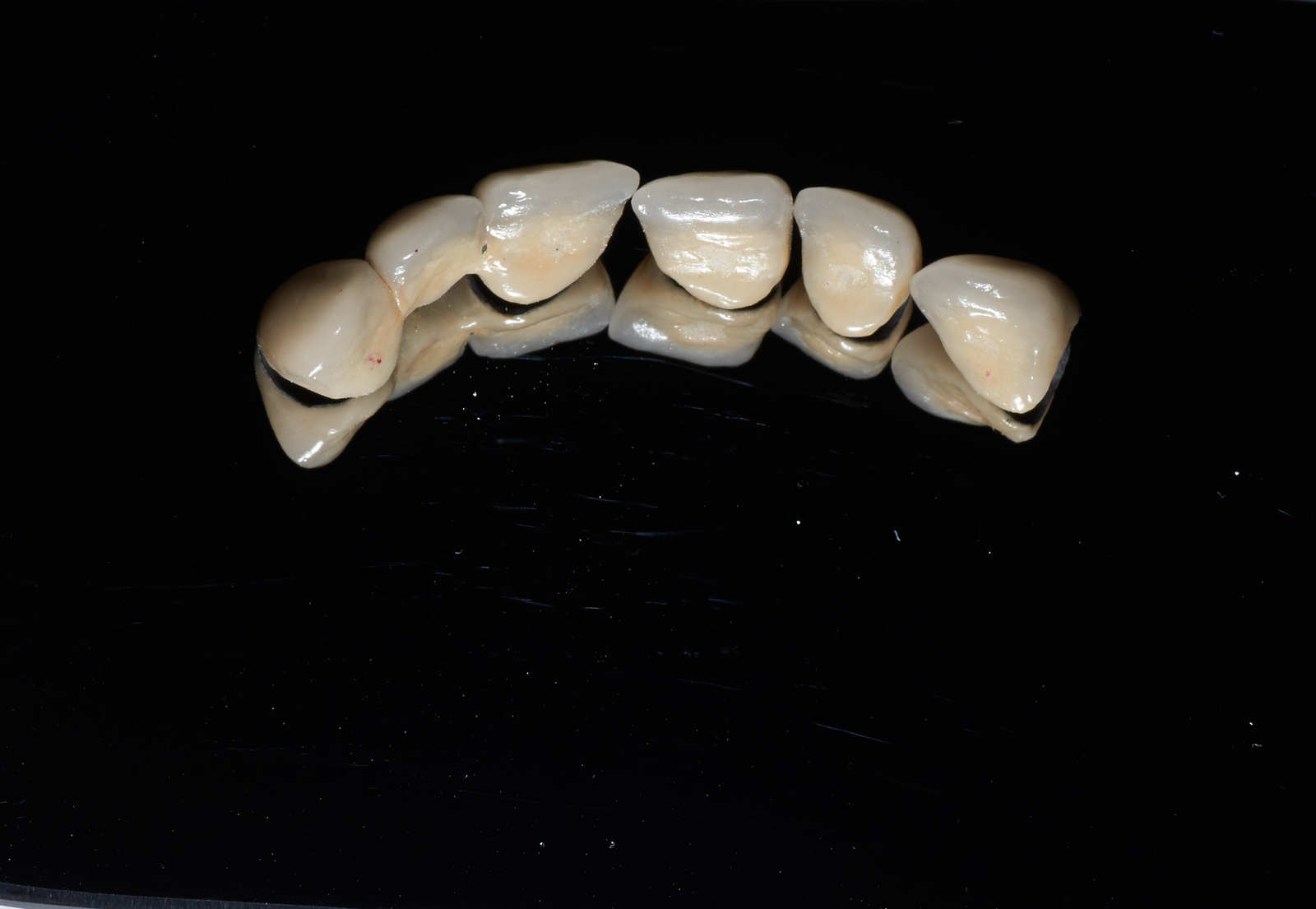 A little makeover - My, Teeth, cermet, Dentistry, Crowns, Work, Longpost