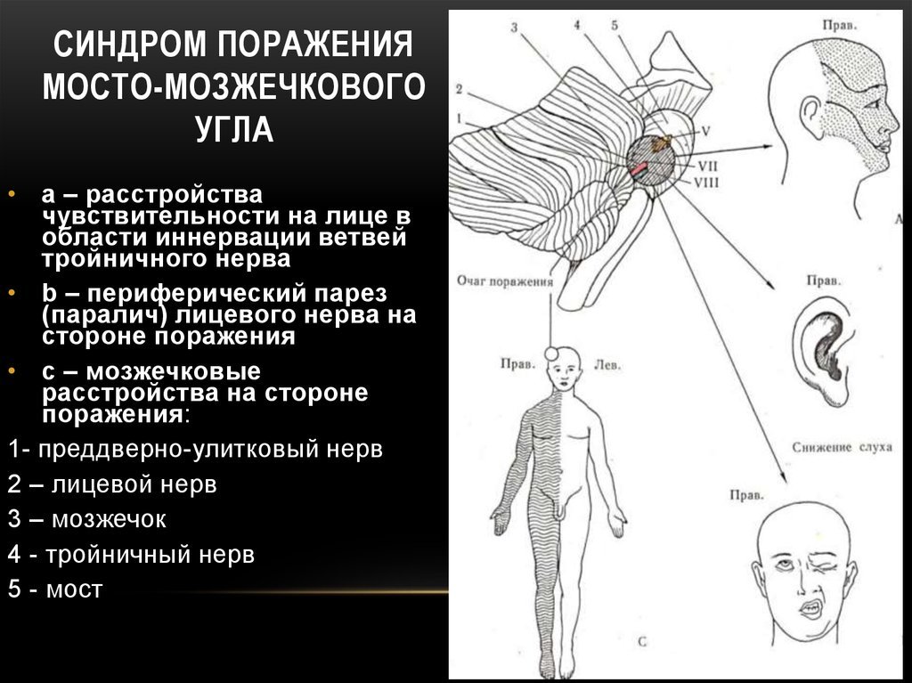 Истории РСЦ. Беременные - Медицина, Медицинские истории, Болезнь, Длиннопост, Длиннотекст, Больница, Неврология