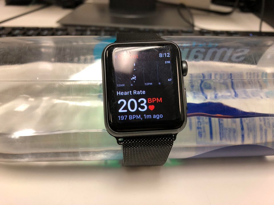 It turns out my water bottle has a heart - The photo, Bottle, Clock, Apple Watch, Heartbeat, Reddit