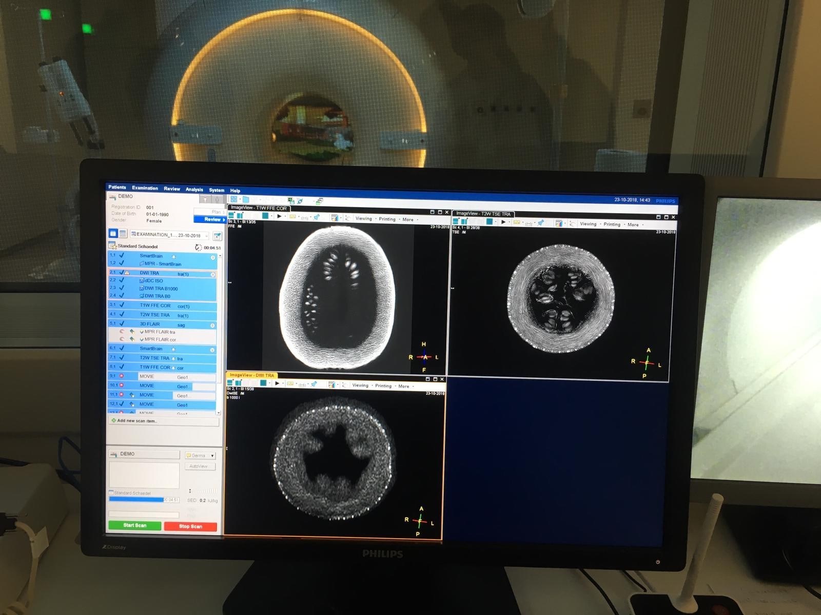 This is what a banana looks like in an MRI, 1.5 Tesla - My, Radiology, MRI, The medicine, Banana