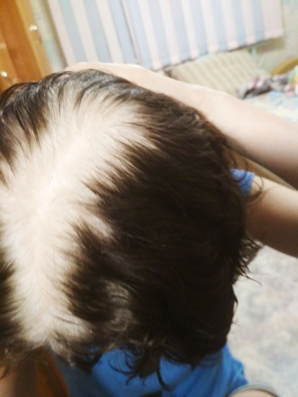 Сонник выпал волос на голове