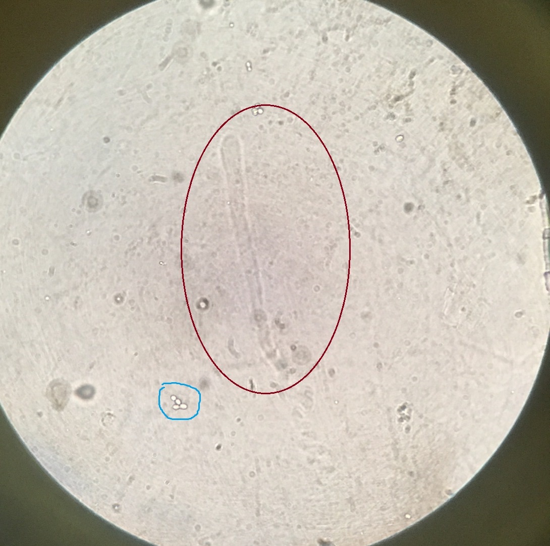 Laboratory diagnostics. Microscopy. - My, Microscopy, Diagnostics, Laboratory, Microscope, Analysis, Longpost, GIF, Video