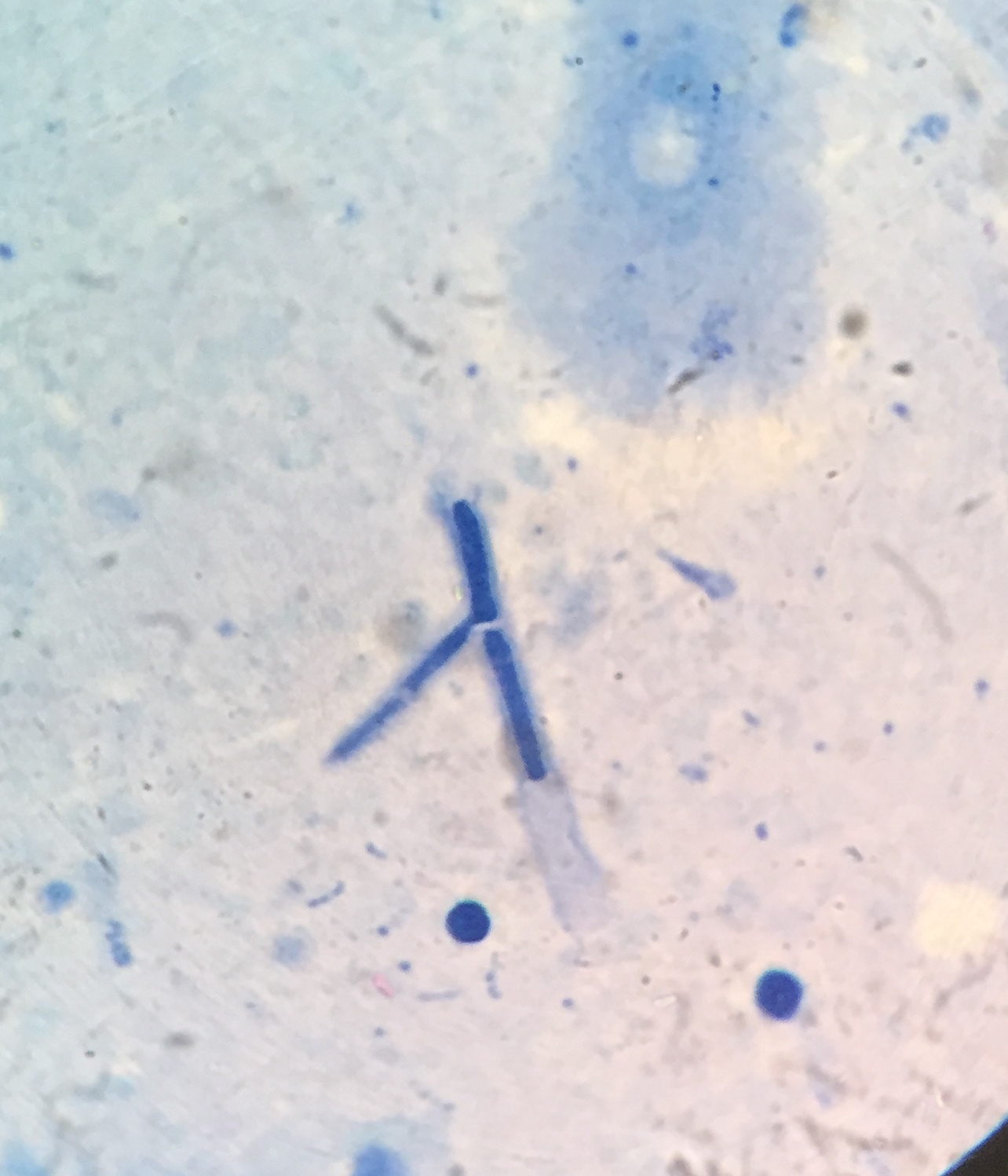 Молочница гриб. Грибы кандида микроскопия. Грибы Candida псевдомицелий. Микроскопия кандиды псевдомицелий. Кандида в мазке микроскопия.