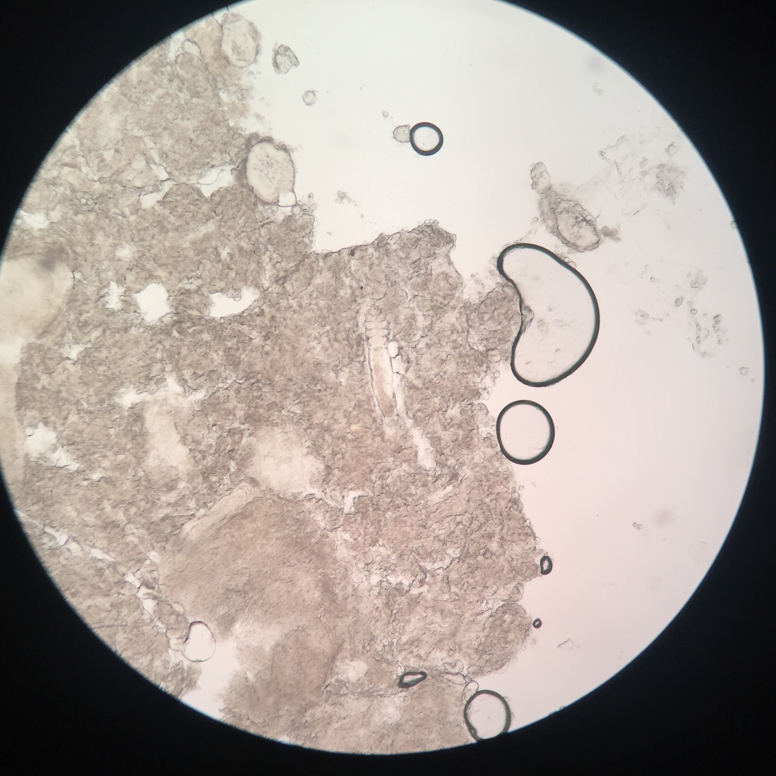 Обида микроскоп. Демодекс соскоб микроскопия. Соскоб с кожи демодекс микроскоп. Микроскопия соскоба кожи.
