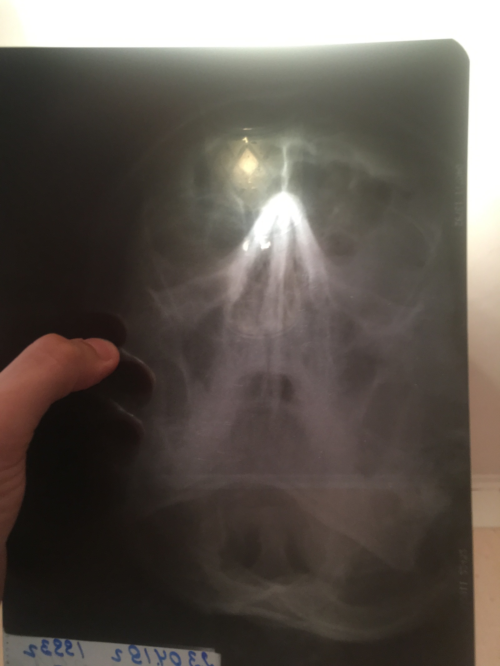 Doctors need advice! - X-ray, Doctors need help, Longpost