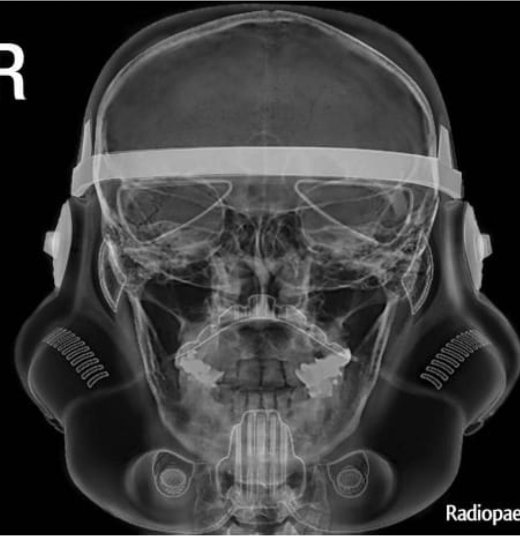 X-ray of the head of a stormtrooper from Star Wars - X-ray, Star Wars, Fake