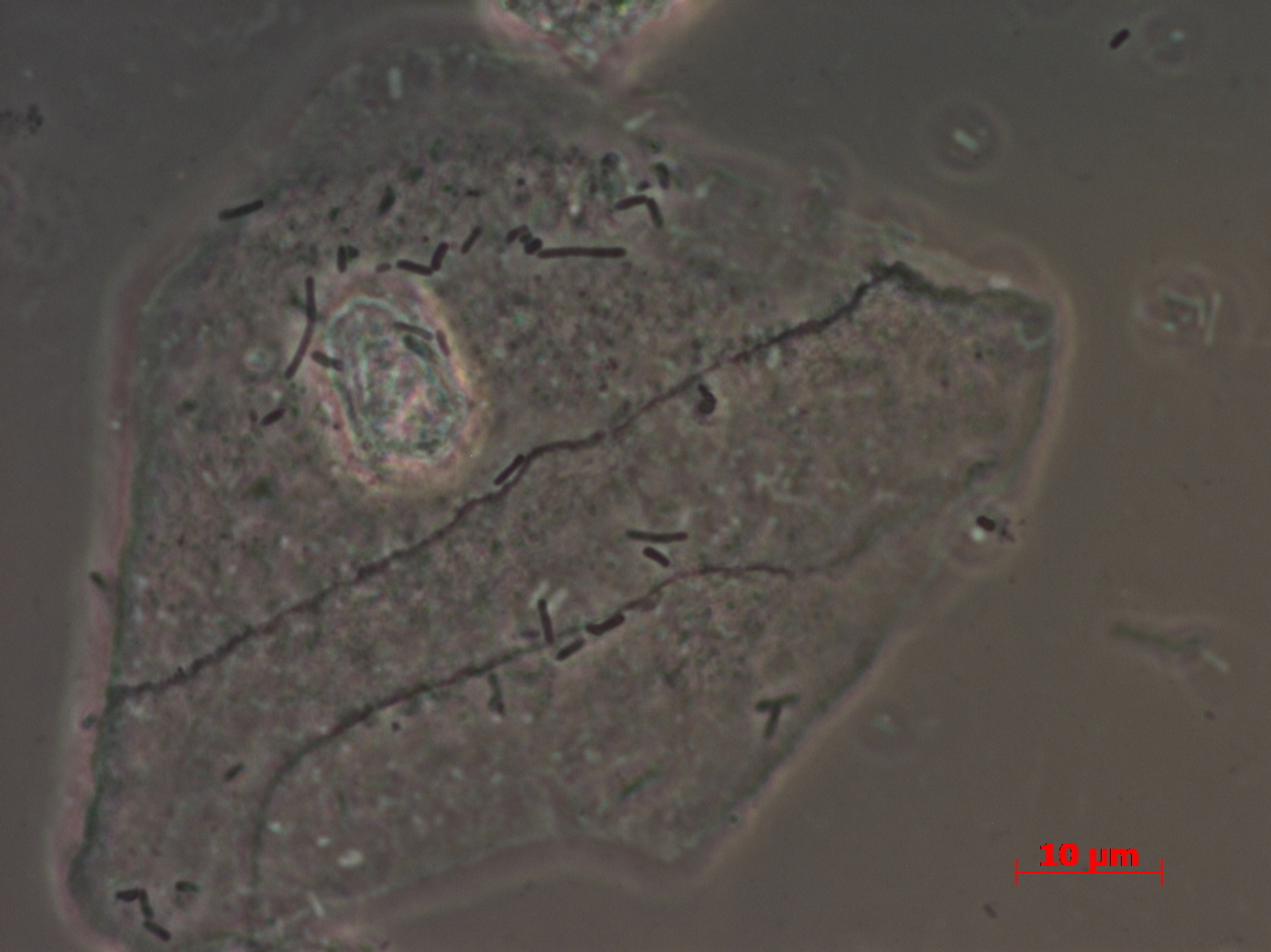 The normal microbiome of the female vagina is part of the immune system. - NSFW, My, Microbiology, Lactobacilli, Hiv, Microbiome, Interesting, Longpost