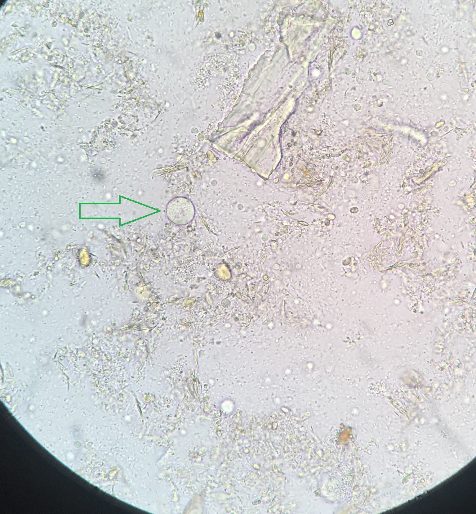 Околоплодные воды микроскопия