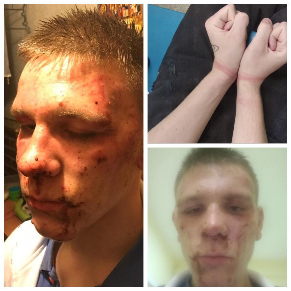 Investigative Committee opened a criminal case on the torture of a teenager in the Kolpino police - Police, Kolpino, Longpost, Police chaos, Werewolves in uniform