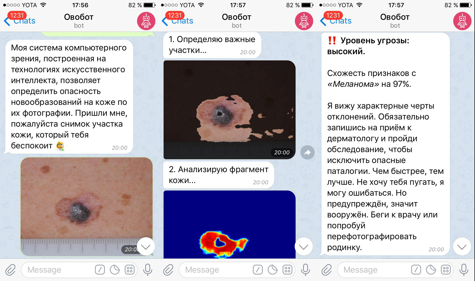 A bot has appeared in Telegram that can detect melanoma from a photo - Health, Useful