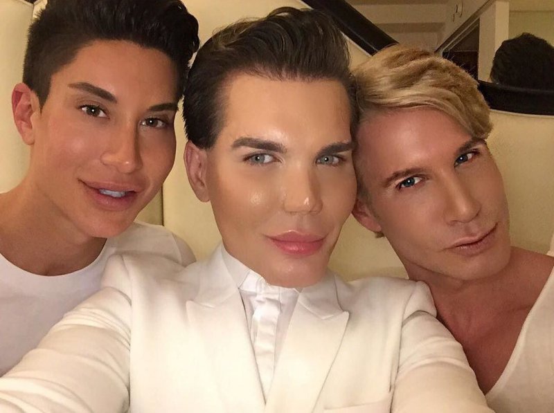 How to turn into a living Ken? Operation history of Rodrigo Alves. - My, Cosmetology, Plastic surgery, Face, The medicine, Fashion, beauty, Psychology, Longpost