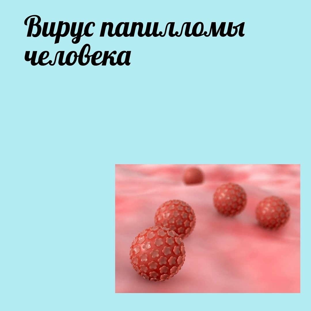 Бородавки - откуда они берутся - Моё, Инфекционные болезни, Впч, Инфекция